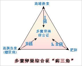 多囊卵巢综合症