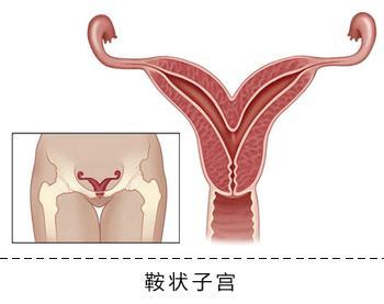 子宫小的症状有什么